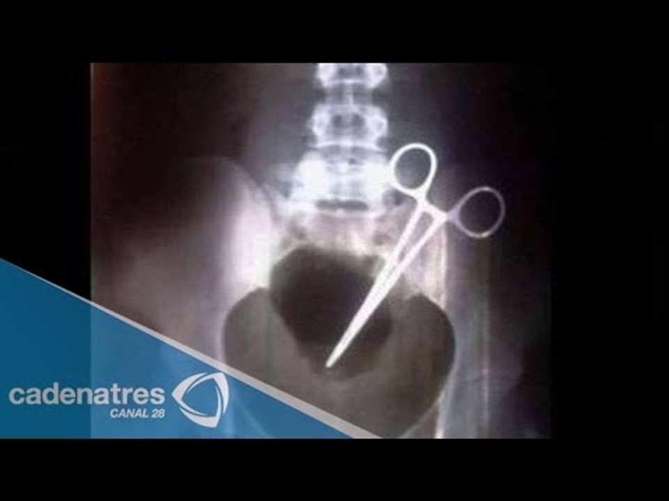 IMPRESIONANTE!!! Le cortan prepucio a un niño de Kínder con tijeras