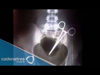 IMPRESIONANTE!!! Le cortan prepucio a un niño de Kínder con tijeras