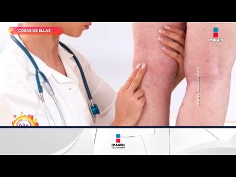 ¡Sigue estos tips para evitar la retención de líquidos! | Sale el Sol