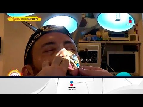 ¡Mauricio Clark compartió detalles de su reconstrucción de nariz! | Sale el Sol