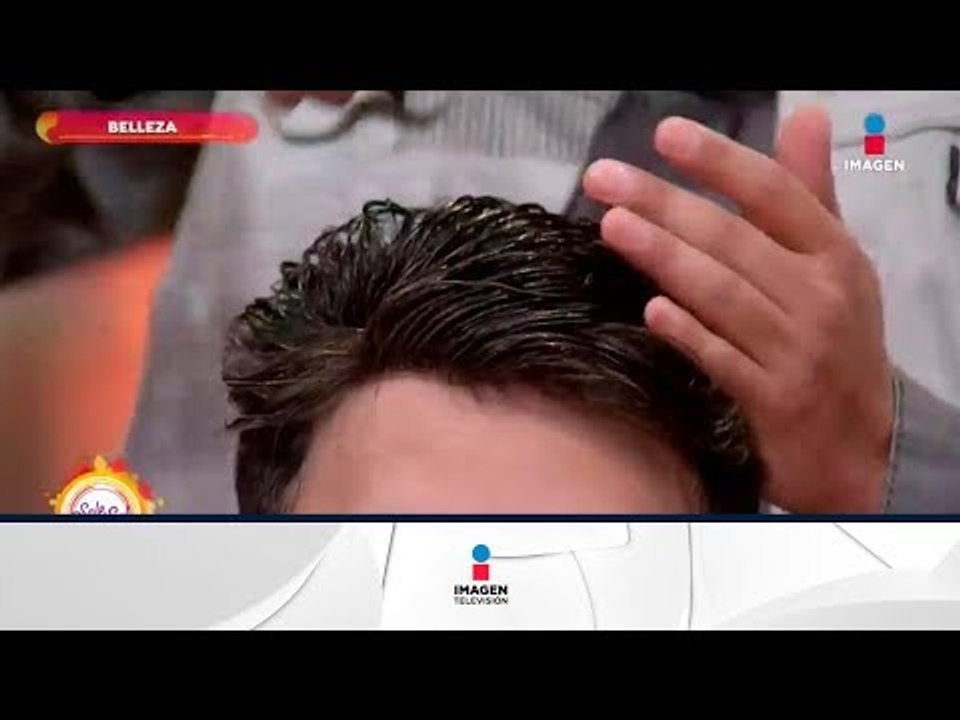¿Sufres de alopecia? ¡Conoce esta solución! | Sale el Sol