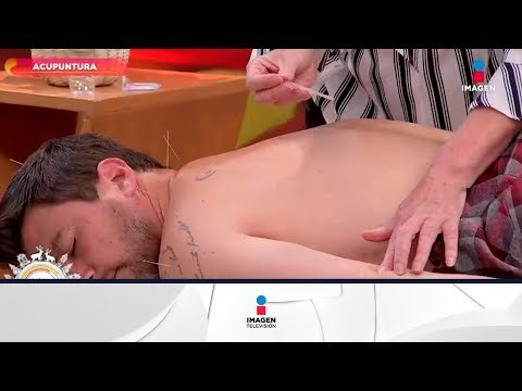 ¡Acupuntura para curar dolores y padecimientos! | Sale el Sol