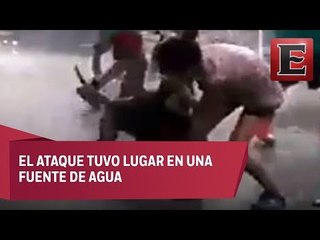 Perro pitbull muerde a niña cuando jugaba en Iztacalco