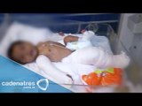 Padres fracturan brazos y pierna de un bebé de dos meses