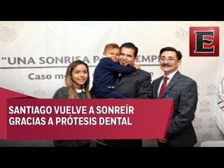 ISSSTE desarrolla prótesis dental a niño de 4 años