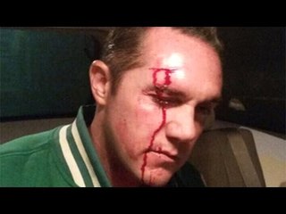 Ex delegado Adrián Rubalcava rinde declaración por riña en Cuajimalpa