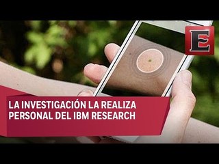 Detección del cáncer de piel por medio de una selfie