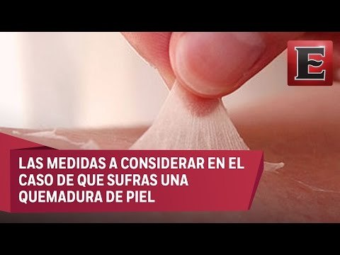 Los tratamientos para las quemaduras de piel
