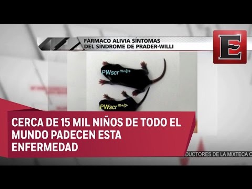 Crean fármaco que alivia síntomas del Síndrome de Prader - Willi