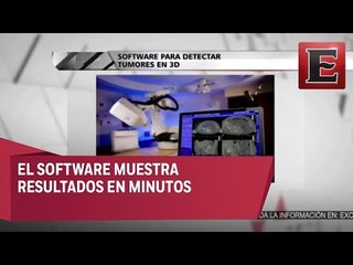 Egresado del IPN desarrolla software para detectar tumores en 3D