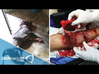 Pitbull destroza el brazo de su dueña