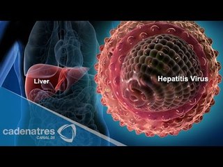 Las impresionantes cifras detrás de la hepatitis alrededor del mundo