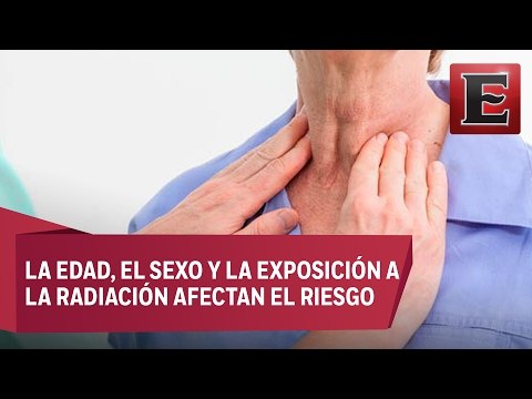 Lo que necesitas saber sobre el cáncer de tiroides