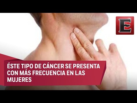 Causas y síntomas del cáncer de tiroides