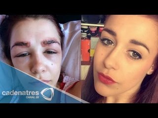 Polly Smith, la joven que terminó con una tragedia facial