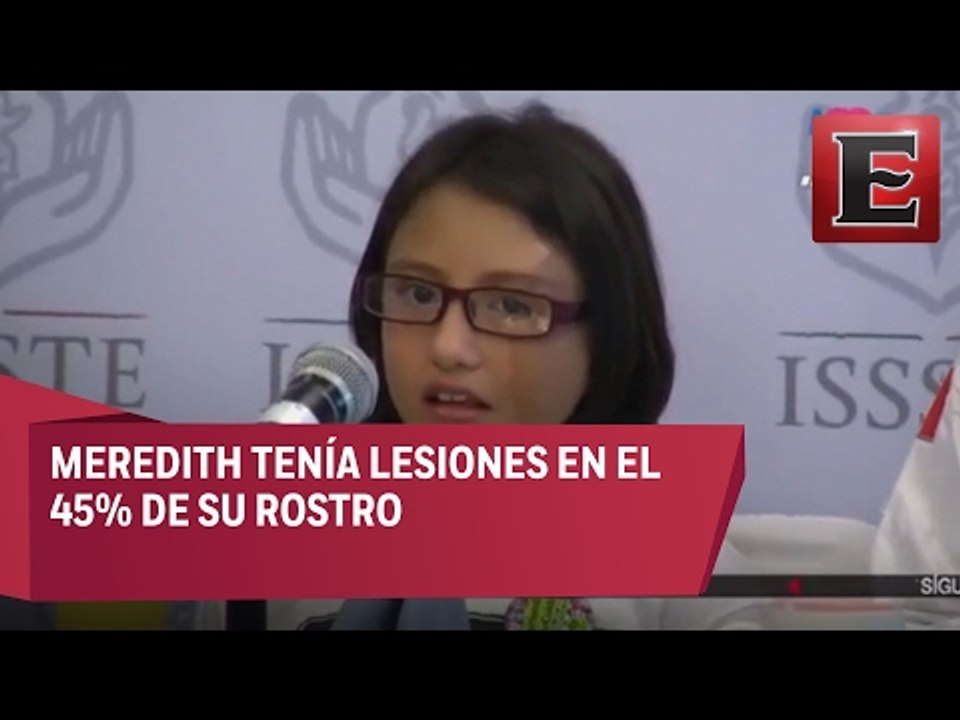 Médicos mexicanos devuelven la sonrisa a niña de siete años