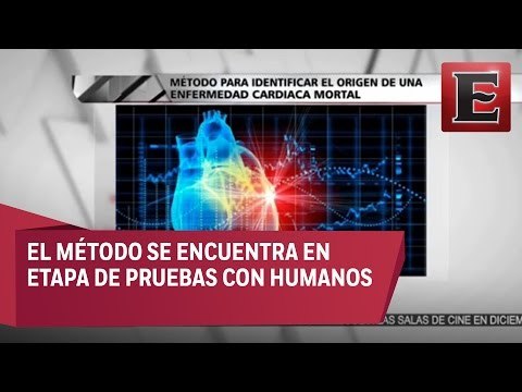 Buscan método para identificar origen de enfermedades cardiacas