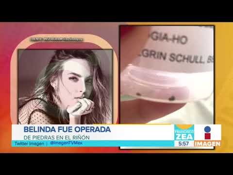 ¡Operan a Belinda de emergencia! | Noticias con Paco Zea