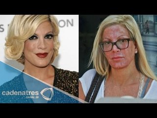 El desfigurado rostro que dejó a Tori Spelling un tratamiento de belleza