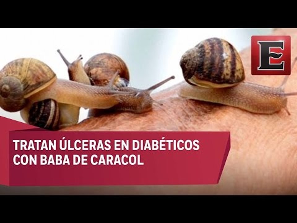 Sintetizan baba de caracol para tratar úlceras en diabéticos