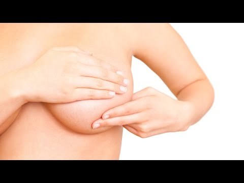 La autoexploración, fundamental en la detección temprana de cáncer de mama