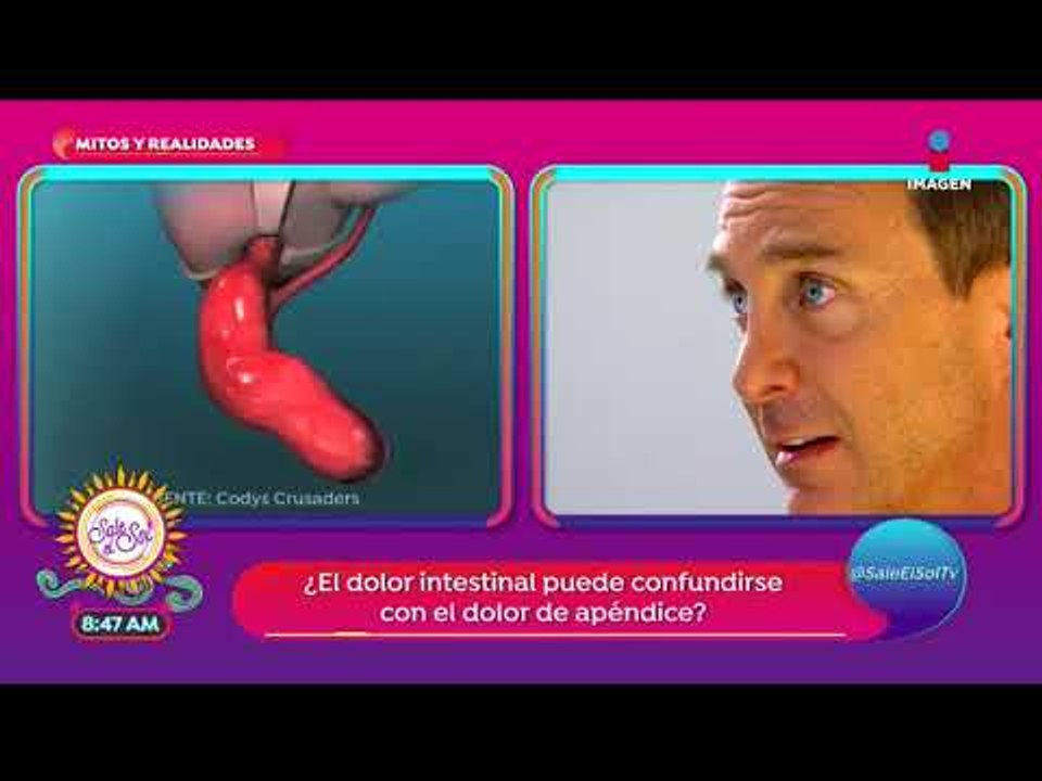 ¿Cómo identificar el dolor de apendicitis? | Sale el Sol