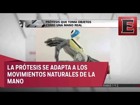 Crean prótesis que sujeta objetos como una mano real