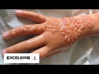 Vacaciones marcan a una niña de por vida WB