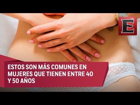 Todo lo que necesitas saber sobre los miomas uterinos