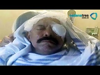 Grave accidente domestico le causa a Oscar de León la perdida de la visión