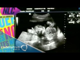 Sandra Echeverría comparte la primera fotografía de su bebé