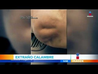 Video de extraño calambre en la pierna se hace viral | Noticias con Francisco Zea