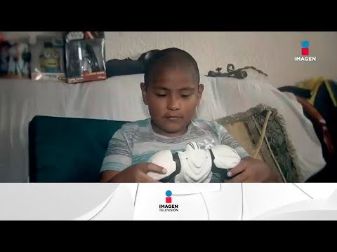 Aumenta el número de enfermos de cáncer en menores | Noticias con Yuriria Sierra