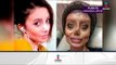 Así luce mujer con 50 cirugías para parecerse a Angelina Jolie | Noticias con Yuriria Sierra