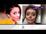 Así luce mujer con 50 cirugías para parecerse a Angelina Jolie | Noticias con Yuriria Sierra
