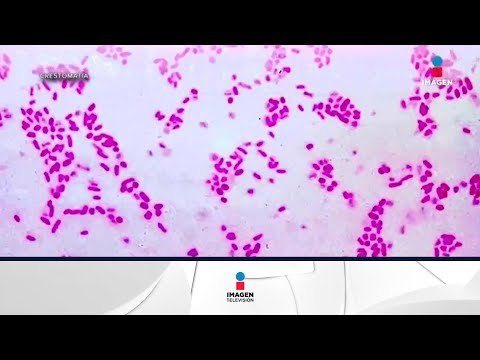 El proyecto que busca identificar a todos los microorganismos del cuerpo humano | Noticias con Zea