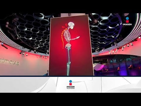 ¡Ten cuidado con la postura al ver el celular! | Noticias con Yuriria