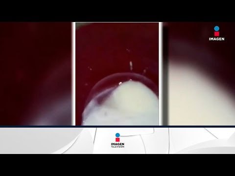 México vende leche pirata a Venezuela | Noticias con Francisco Zea