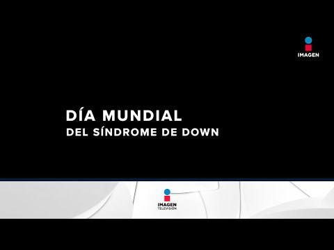 ¡Hoy es el día mundial del síndrome de Down! | Noticias con Francisco Zea