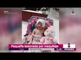 Hospitalizan a niña por usar maquillaje de niños | Noticias con Yuriria Sierra
