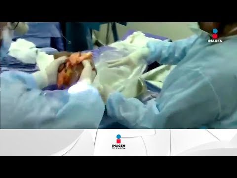 Mexicanos podrán ser donadores de órganos obligatorios | Noticias con Yuriria Sierra