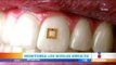 Desarrollan sensor adherido al diente para controlar niveles de glucosa | Noticias con Francisco Zea