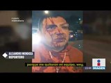 Policías golpearon a reportero durante operativo en la Doctores | Noticias con Ciro