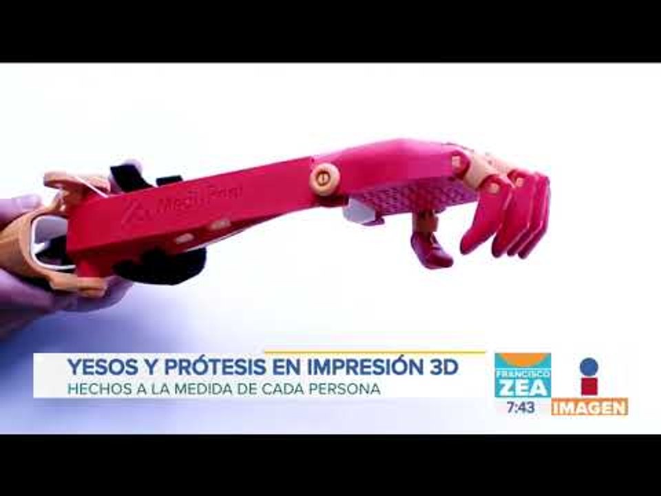 Este mexicano crea yesos y prótesis, y los dona a víctimas de todo México | Noticias con Zea
