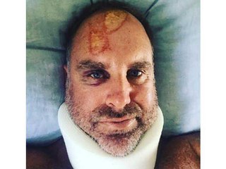 മുൻ ഓസീസ് താരം മാത്യു ഹെയ്ഡന് ഗുരുതര പരിക്ക് | Oneindia Malayalam