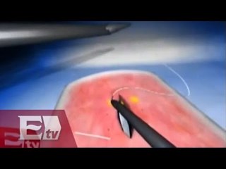 Simulador de suturas médicas hecho en México / Paul Lara