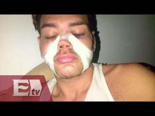 Se somete a cuatro cirugías para parecerse a Ricky Martin / Joanna Vegabiestro