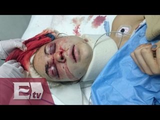 Nieta de Cantinflas es brutalmente golpeada por su esposo / Joanna Vegabiestro