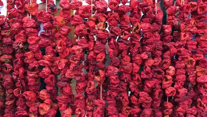 'Acı'ya dayanıklılıkları şaşırtıyor - ŞANLIURFA