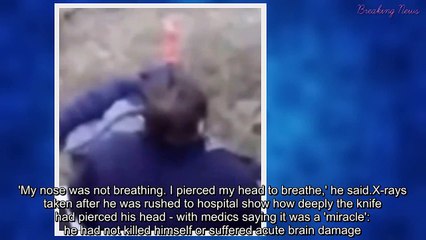 கத்தியை எடுத்து தலையில் குத்திக்கொண்ட மனிதர்-வீடியோ